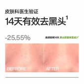 理然有效控油2件套（有效控油洁面乳150g+水凝露100g）