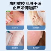 日本叮叮清凉止痒液走珠装50ml/盒
